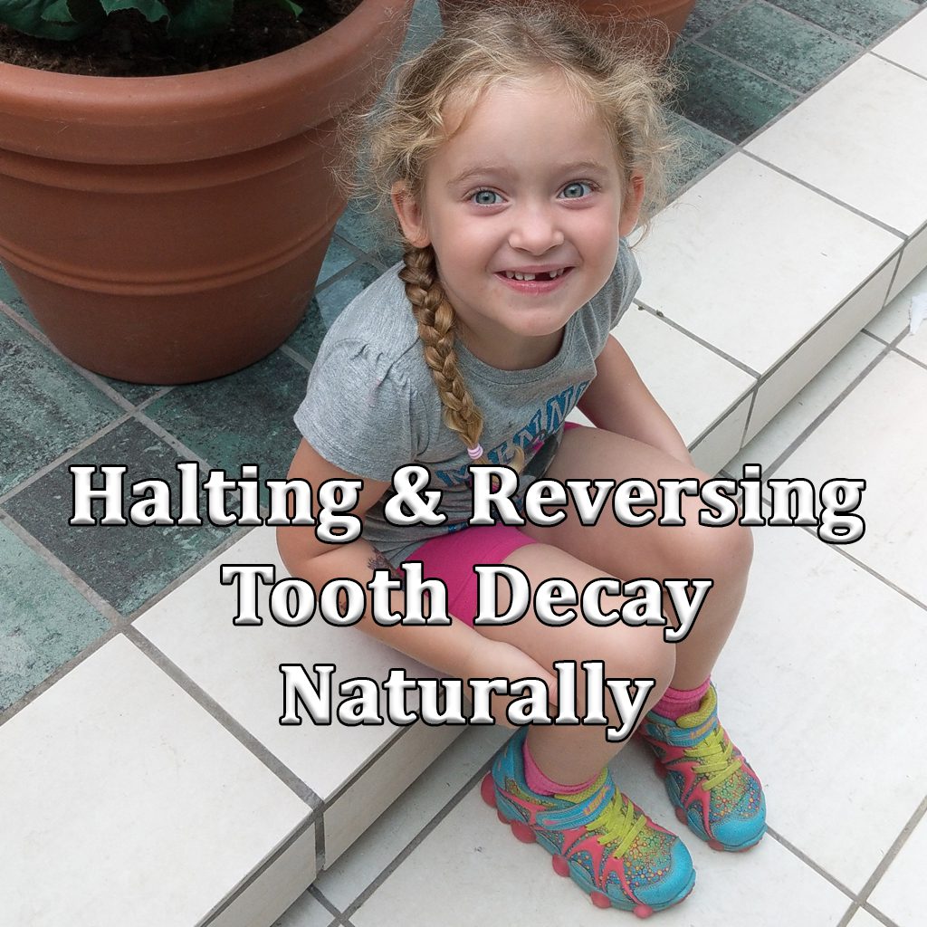 reversing tooth decay
